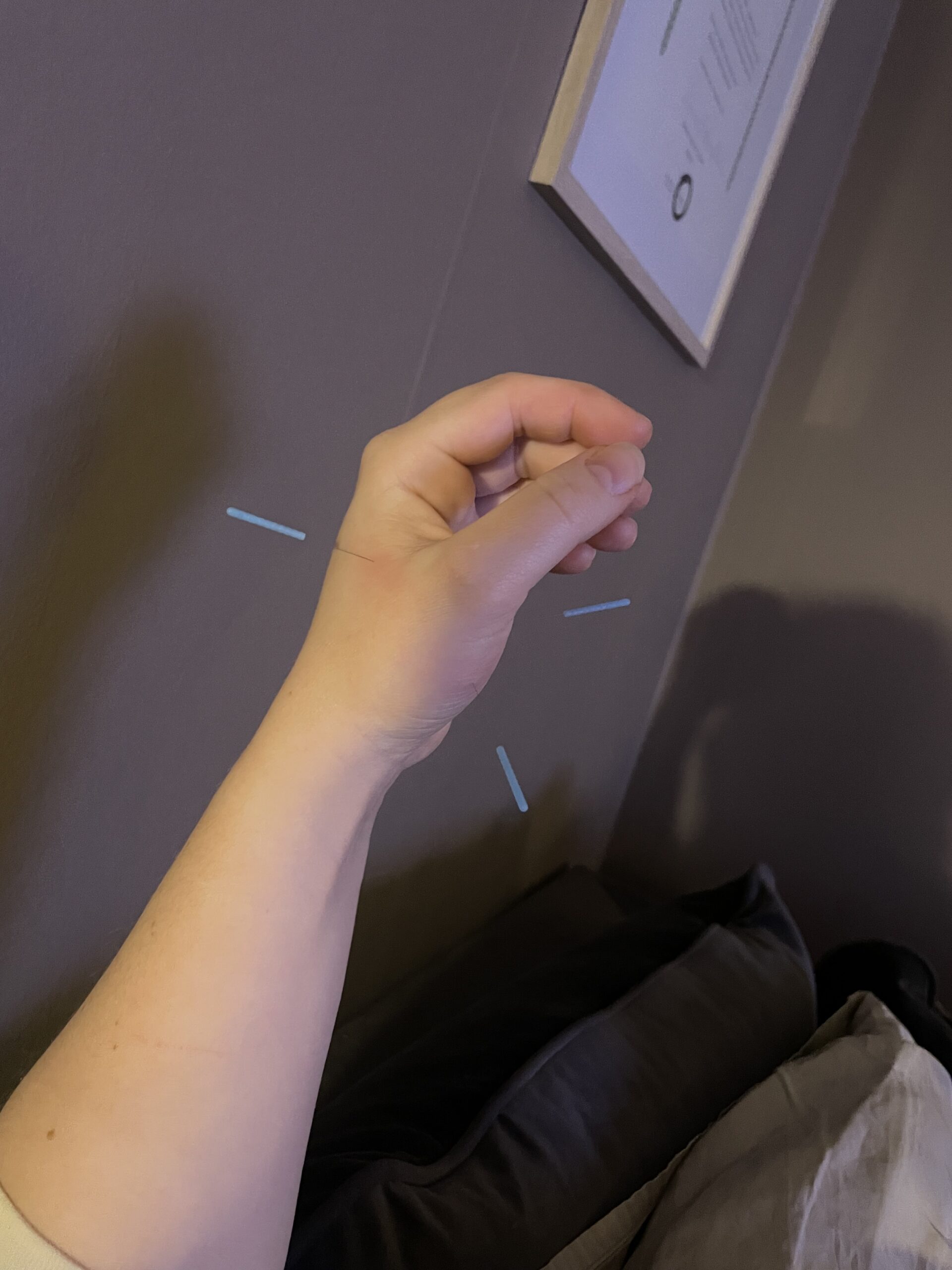 Häst & Humanakupunktur